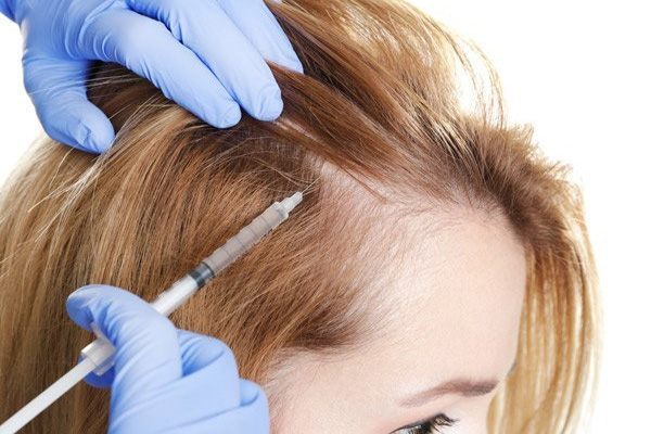 PRP / GFC For Hair Loss